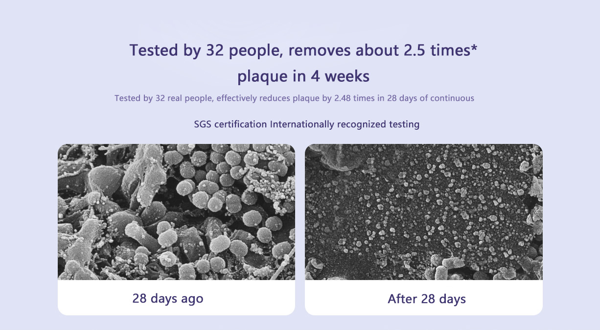 Mijia Sonic Electric Toothbrush T302 4-Brush Head Set 4 Weeks Double Plaque Removal 4 Clean Tooth Modes